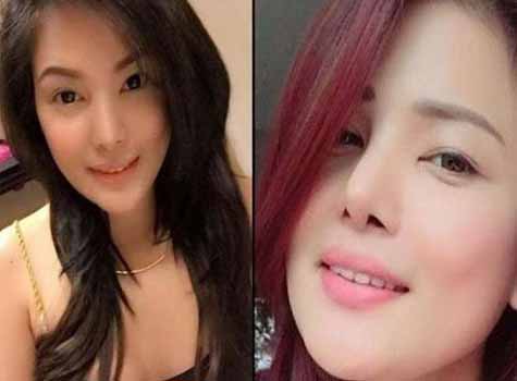 Wanita Cantik Ini Tewas saat di Meja Operasi Plastik Dada dan Bokong 