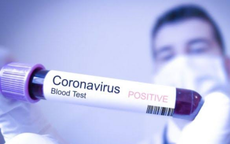 Pemerintah Pastikan Pembiayaan Pelayanan Kesehatan Akibat Virus Corona