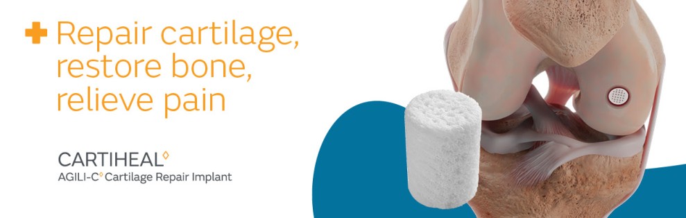 New data for Smith+Nephew’s CARTIHEAL◊ AGILI-C◊ Cartilage Repair Implant demonstrates superior pain relief and functional gains at 5-years