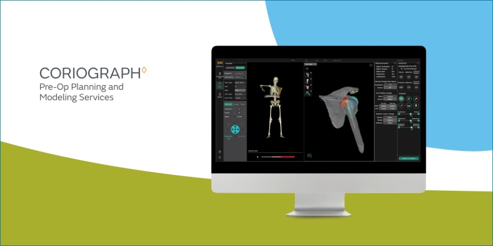 Smith+Nephew Launches CORIOGRAPH™ Pre-Op Planning and Modeling Services for Total Shoulder Arthroplasty