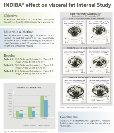 Case Study Highlights INDIBA 448 kHz Radiofrequency’s Role in Visceral Fat Reduction and Prevention of Fat Accumulation