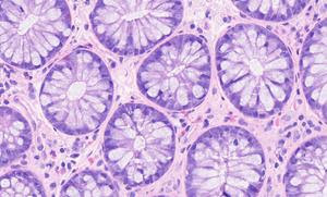 EVIDENT to Acquire Pramana, Inc.